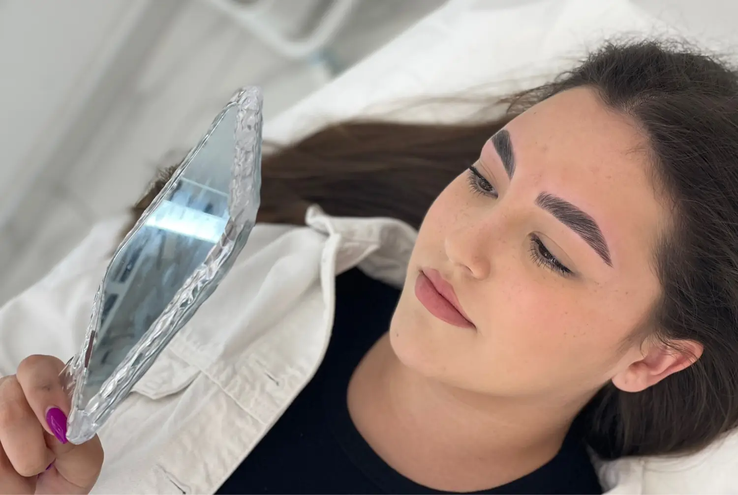 Brow lift — fotografija 6